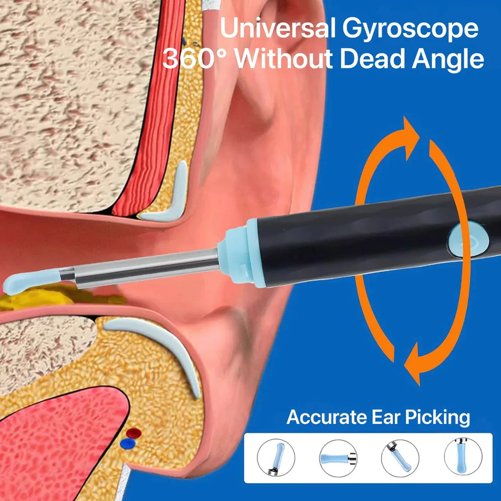 Ear Wax Cleaner with 1296P HD Clear Camera,Ear Cleaning Tool Kit, Wireless EarScope for Adults and Kids, Ear wax Removal Tool with light
